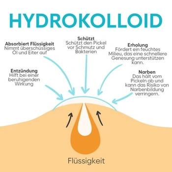 Náplasti na pupínky se směsí hydrokoloidů v 6 velikostech 128 kusů 128 náplastí