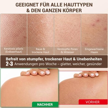 2dielna sada exfoliačných rukavíc, rukavice na telový peeling pre ženy a mužov