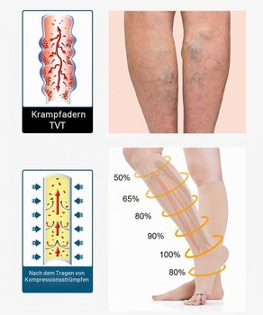 Kompresní punčochy s otevřenou špičkou pro ženy a muže 20-30 mmHg třída 2, velikosti S-4XL,