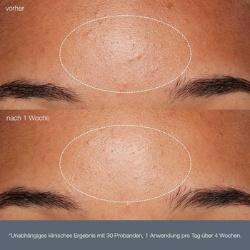 Dermalogica Daily Microfoliant Enzyme Peel 13g Cestovné balenie 13g (1 balenie)