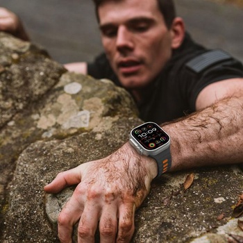 Chinbersky 2 kusy Alpine Loop kompatibilný s Apple Watch Band 45 mm 44 mm 46 mm 49 mm 42 mm 41 mm
