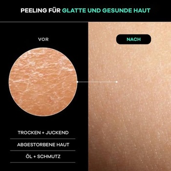 Dermasuri Deep Exfoliating Back Scrubber – Exfoliačná osuška – Sprchová huba s dvojitou textúrou –