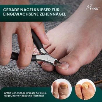 FVION 5dielna sada na pedikúru, profesionálne klieštiky na nechty na nohách, podiatrické nástroje,