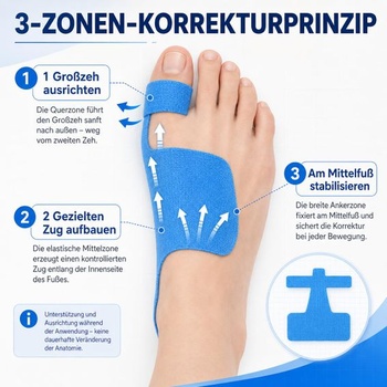 Páska na Hallux Valgus, korekčná páska na Hallux Valgus, kineziologická páska