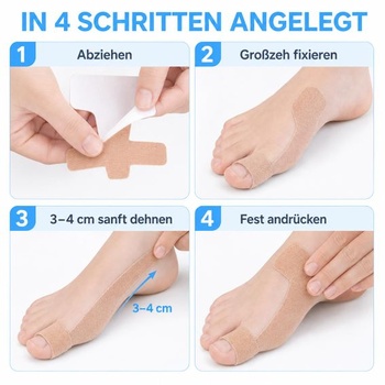 Páska na Hallux Valgus, korekčná páska na Hallux Valgus, kineziologická páska