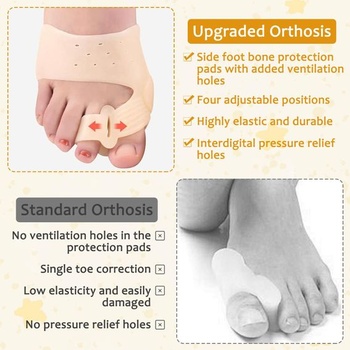 Korekcia Hallux valgus, rozťahovače prstov na hallux valgus, balenie 3 párov, mäkký materiál, pohodlné