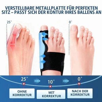2x korekčná dlaha na Hallux Valgus - narovnanie prstov cez deň aj v noci, bandáž na Hallux Valgus pre