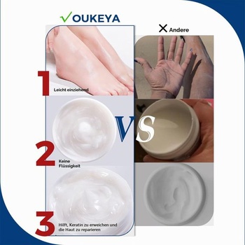 OUKEYA New Formula Urea Cream 40% plus kyselina salicylová 2%, hydratačný a regeneračný krém na