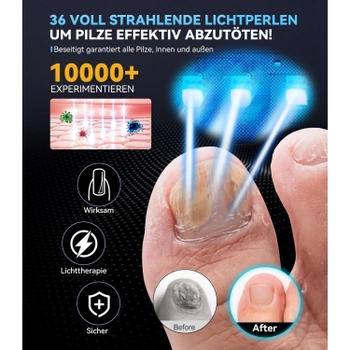 Laserové ošetření plísně XSWCCJJ, lila