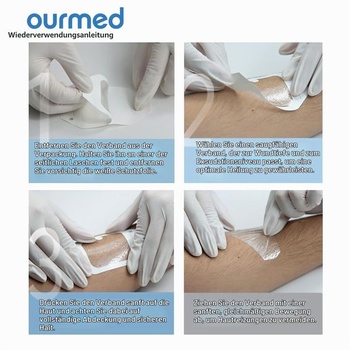 Průhledný filmový obvaz Ourmed, 50 kusů, voděodolné průhledné samolepicí náplasti 10x12cm, obvaz na