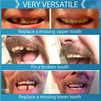 Sada přilepovacích zubů Instant Smile 12281