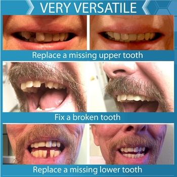 Súprava prilepovacích zubov Instant Smile 12281