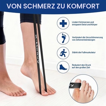 Tréningový pás na rozťahovanie prstov na Hallux Valgus, 5 kusov, korekcia Hallux Valgus, tréningový pás