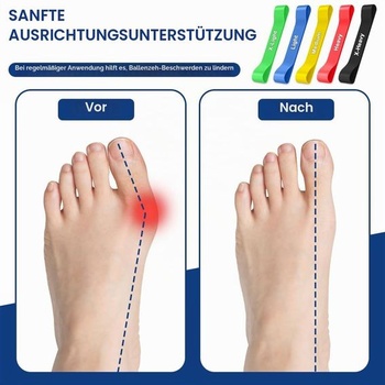 Tréningový pás na rozťahovanie prstov na Hallux Valgus, 5 kusov, korekcia Hallux Valgus, tréningový pás