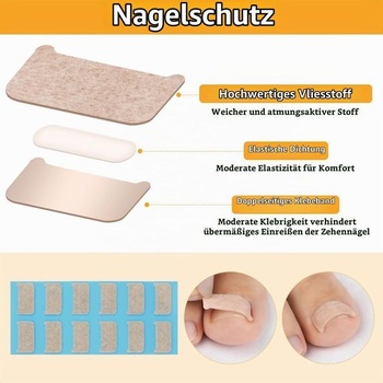 Náplasti na korekciu zarastených nechtov Beugo, sada 167 kusov, sada 167*náplastí na korekciu zarastených