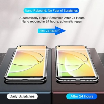 2 kusy hydrogélovej ochrannej fólie na displej pre Realme 16 Pro 5G (6,78