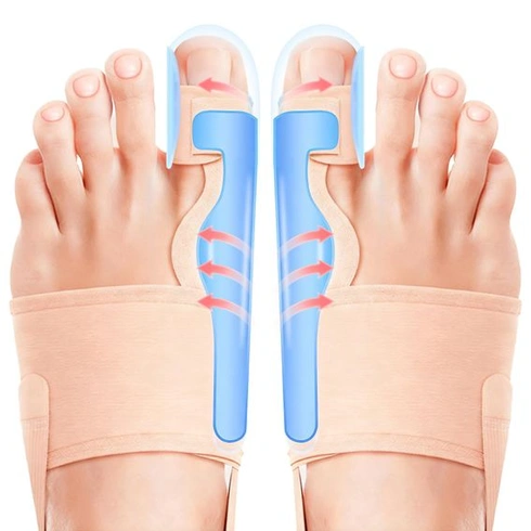 2x korekčná dlaha na Hallux Valgus - narovnanie prstov cez deň aj v noci, bandáž na Hallux Valgus pre