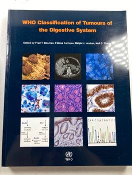 The International Agency for Research on Cancer: WHO Classification of Tumours of the Digestive Syst